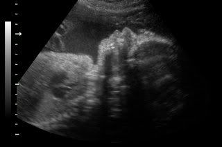 My NEW GRANDCHILD -