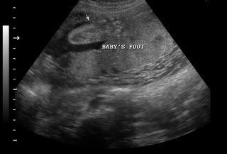 My NEW GRANDCHILD -