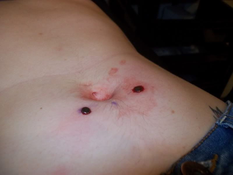 videos, the secong dermal piercing bled alot, so second and third video have 