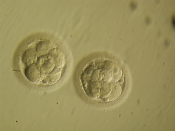 embryo pic