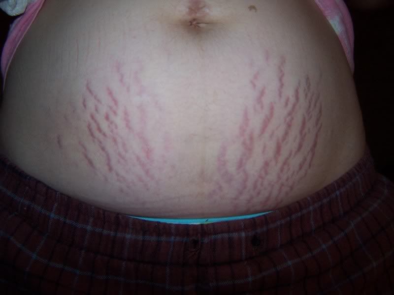 Belly Ring Pregnant